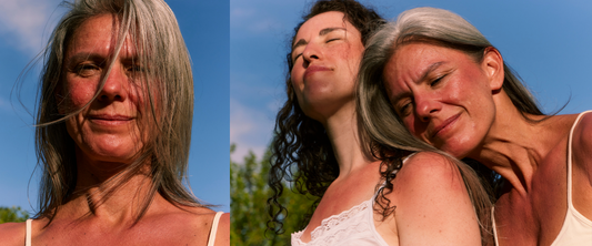 Sonnenbrand? Soforthilfe bei Sonnenbrand